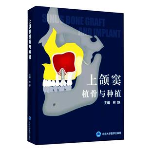 正版 上颌窦植骨与种植书 林野 主编 口腔种植学书籍和牙手术学图解美学区域的修复精准植入技巧数字化实用技术精要现代牙科牙体