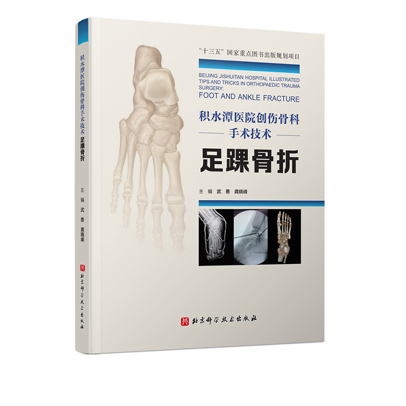 北京科学技术骨科手术