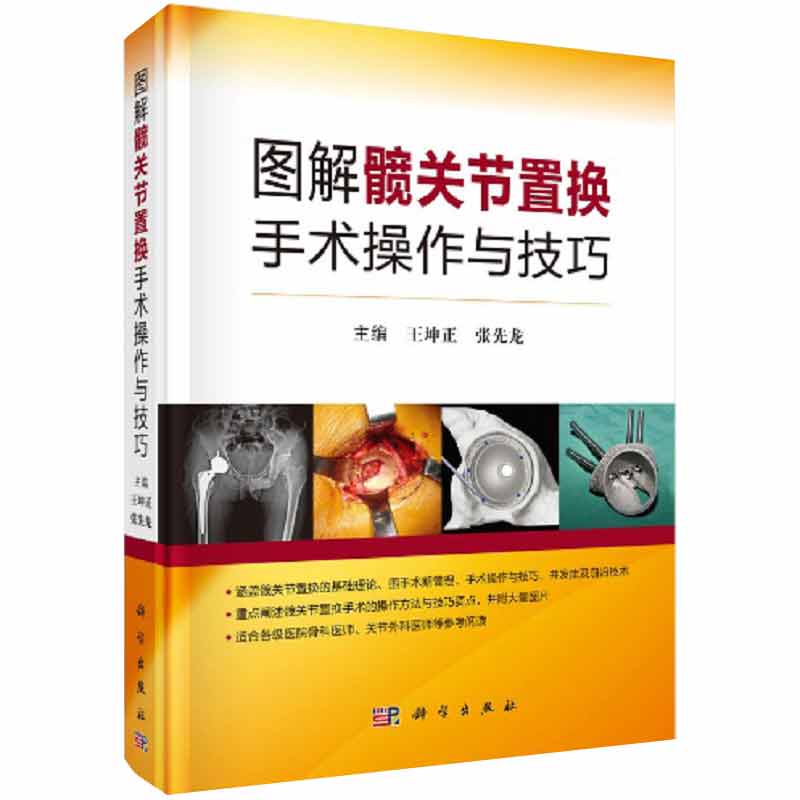 图解髋关节置换手术操作与技巧 9787030656667 科学出版社 对关节外科医师而言是一本难得的参考书和工具书 坤正 张先龙主编