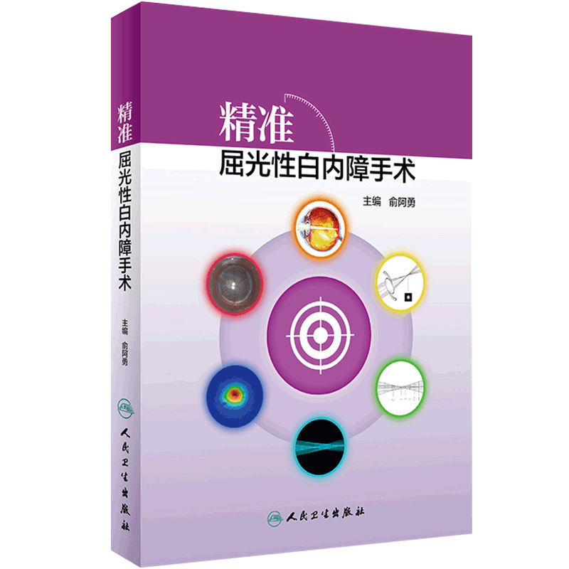 精准屈光性白内障手术俞阿勇