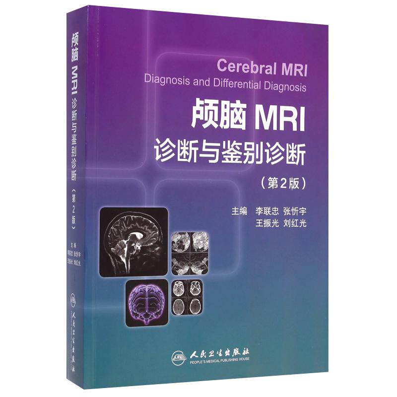 颅脑MRI诊断与鉴别诊断(第2版)李联忠 临床颅脑疾病CT图谱 磁共振核磁共振成像诊断学原理与技术 人民卫生 9787117198318