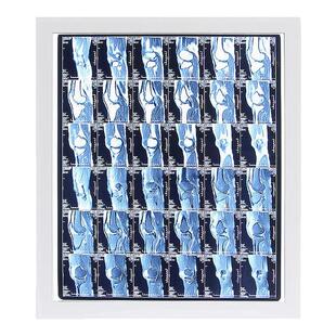 医用LED观片灯超薄X光观片灯骨科看片灯牙科双三联医用阅片灯