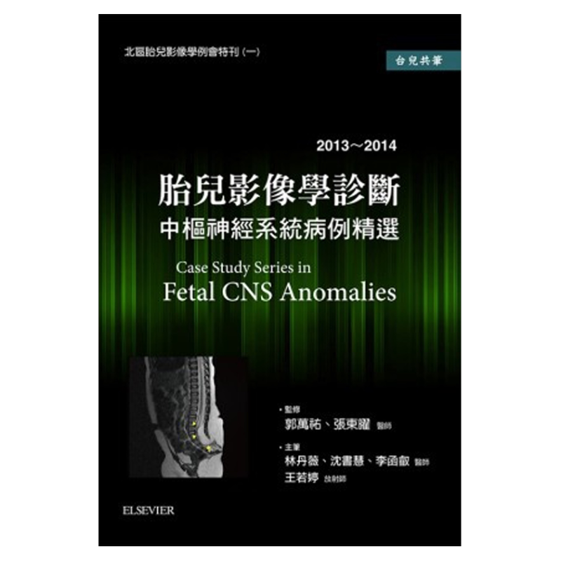 胎儿影像学诊断中枢神经系统