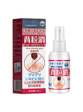 背粒消喷雾胸前胸后背祛痘痘背部背后背上长去除螨胸口水杨酸身体