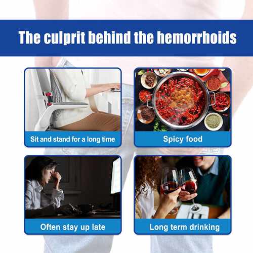 Hemorrhoids Capsules Relieve Anal Pain Internal External Mix