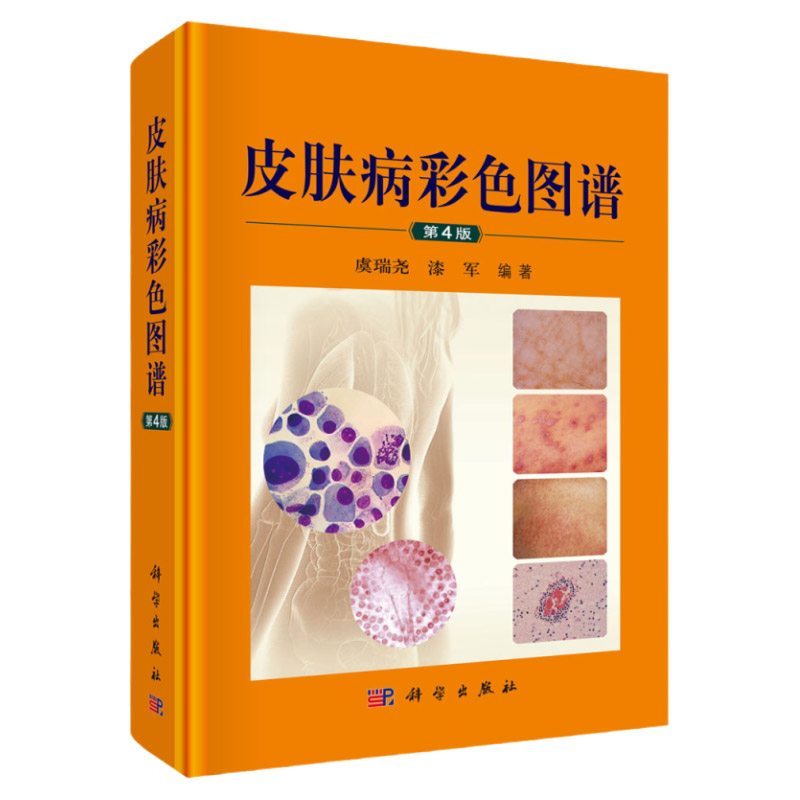 皮肤病彩色图谱 第4版 700余种皮肤性病科的常见病 多发病和一些少见病 疑难病 皮肤病学 虞瑞尧 漆军 9787030617637 科学出版社