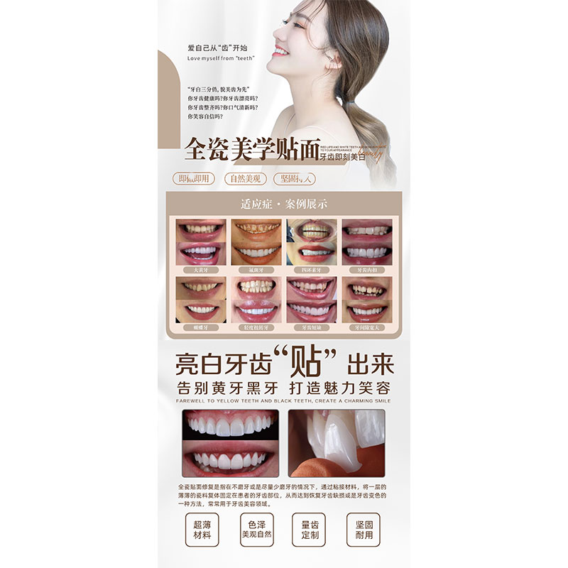 超薄瓷贴面海报牙贴面展架美白图