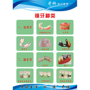 牙科知识挂图烤瓷牙口腔诊所海报二氧化锆全瓷牙镶牙种类广告洗牙