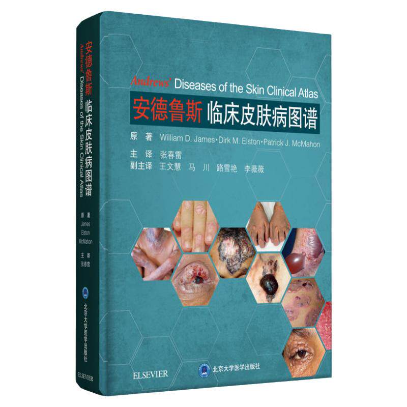 安德鲁斯临床皮肤病图谱 临床皮肤病学 张春雷 皮肤科疾病临床症状诊断治疗书籍皮肤科工具书9787565920691北京大学医学出版社