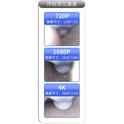 清洁耳朵丨可视化掏耳勺洁耳仪器
