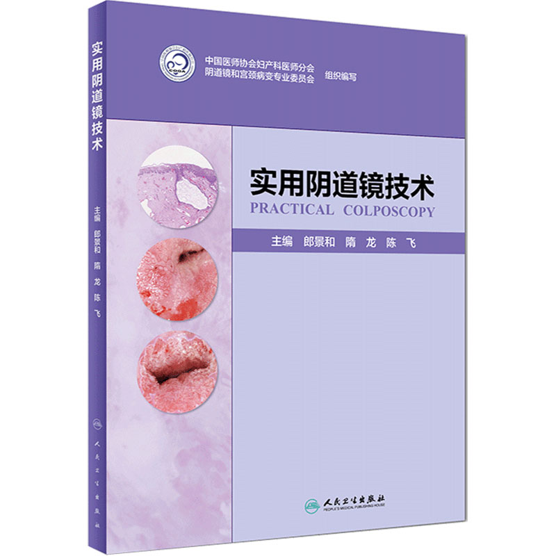 旗舰店现货实用阴道镜技术郎景