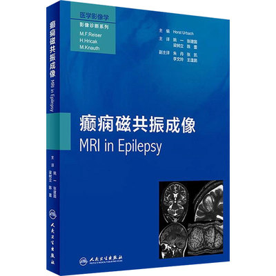 癫痫磁共振成像翻译版