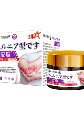 【治疗牛皮藓银屑专用】