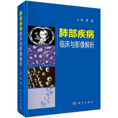 【2025新版】肺部疾病临床与影像解析第2二版张嵩肺部疾病的临床影像特点影像的诊断和鉴别诊断大量病例9787030808776科学出版社