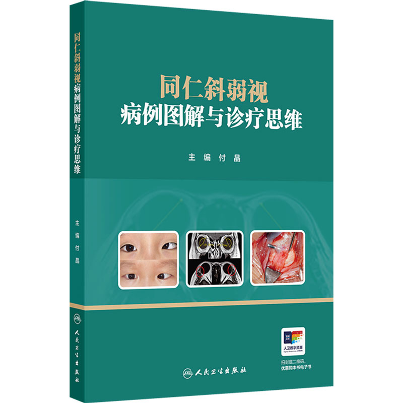 同仁斜弱视病例图解与诊疗思维付晶诊断治疗斜视弱视儿童屈光不正先天小儿眼科视功能康复近视防控人民卫生出版社临床眼科学专著