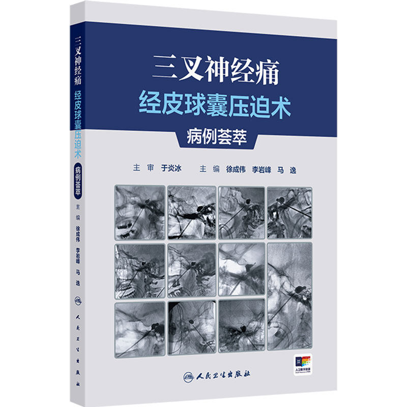 三叉神经痛经皮球囊压迫术病例荟萃 徐成伟 李岩峰 马逸 主编 经皮球囊压迫术治疗三叉神经痛手术技巧案例 人民卫生出版社