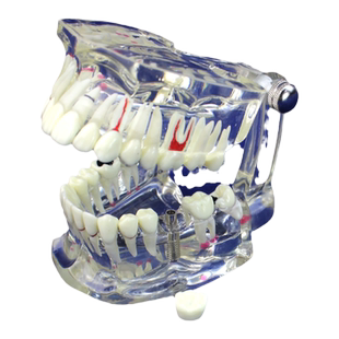 ENOVO颐诺牙齿模型口腔牙齿科种植模型口腔病理模型种植体牙冠义齿口腔囊肿根管模型