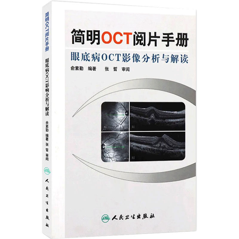 简明OCT阅片手册 眼底病眼科OCT影像分析与解读 俞素勤编著 基础阅片影像眼科学视光技术应用 人民卫生出版社9787117157551