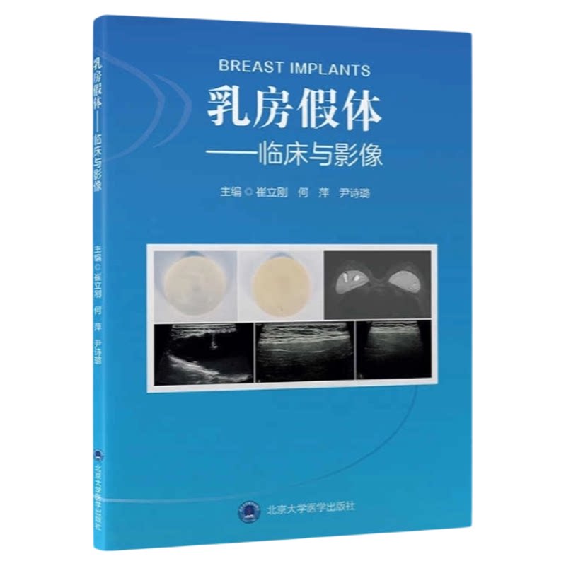 乳房假体植入超声指导手册