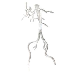 ENOVO颐诺 人体外周介入训练模型外周血管介入治疗器械操作练习教具桡动脉入路外周介入介入诊疗∕介入放射学