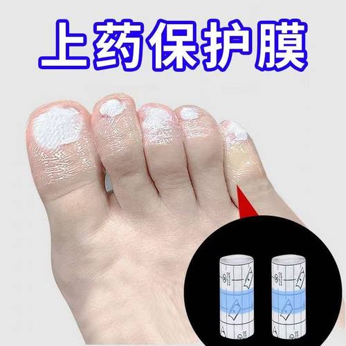 灰指甲上药套灰指甲脚趾手指保护套脚指抹药上药防护套保护脚趾