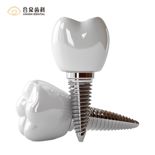 北京种植牙套餐瑞士ITI 口腔旗舰店进口种牙植牙全瓷牙冠合众齿科