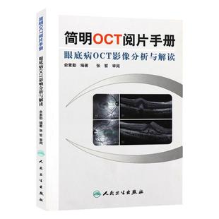 简明OCT阅片手册 眼底病眼科OCT影像分析与解读 俞素勤编著 基础阅片影像眼科学视光技术应用 人民卫生出版社9787117157551