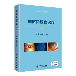 正版  图解角膜病诊疗 眼表疾病临床系列 眼科治疗整形眼科学眼科图谱 角膜病诊断治疗 角膜病专业医师临床书籍 人民卫生出版社