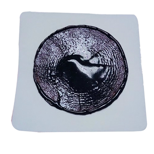 多囊卵巢综合征调理月经不调内膜薄子宫淤堵疏通卵巢囊肿中药贴