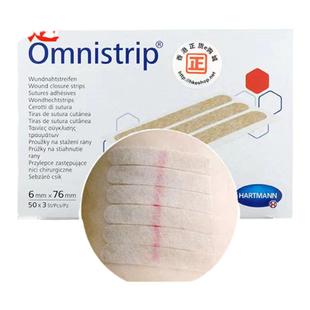 德国omnistrip减张贴剖腹产防变宽增生德免缝胶带儿童面部伤口贴