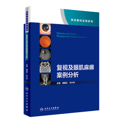 复视及眼肌麻痹案例分析神经眼科实用系列 田国红孙兴怀 眼科学视神经疾病看图识病疑难杂症罕见病例人民卫生出版社眼科书籍
