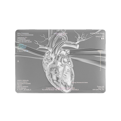 MIUCHO心脏银色macbook14电脑壳