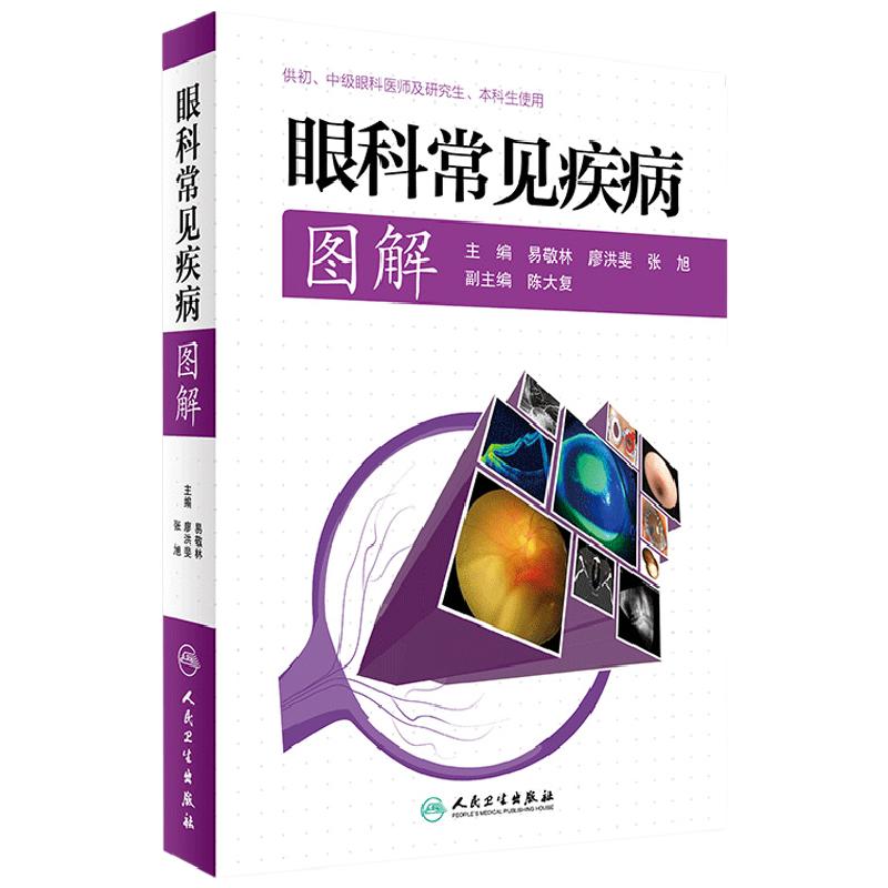 眼科常见疾病图解 供初中级眼科医师及研究所本科生实用书籍 易敬林 张旭 人民卫生出版社9787117229142