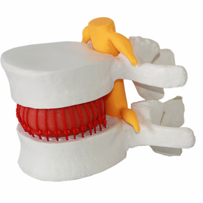 美善模型人体脊柱腰椎演示教具