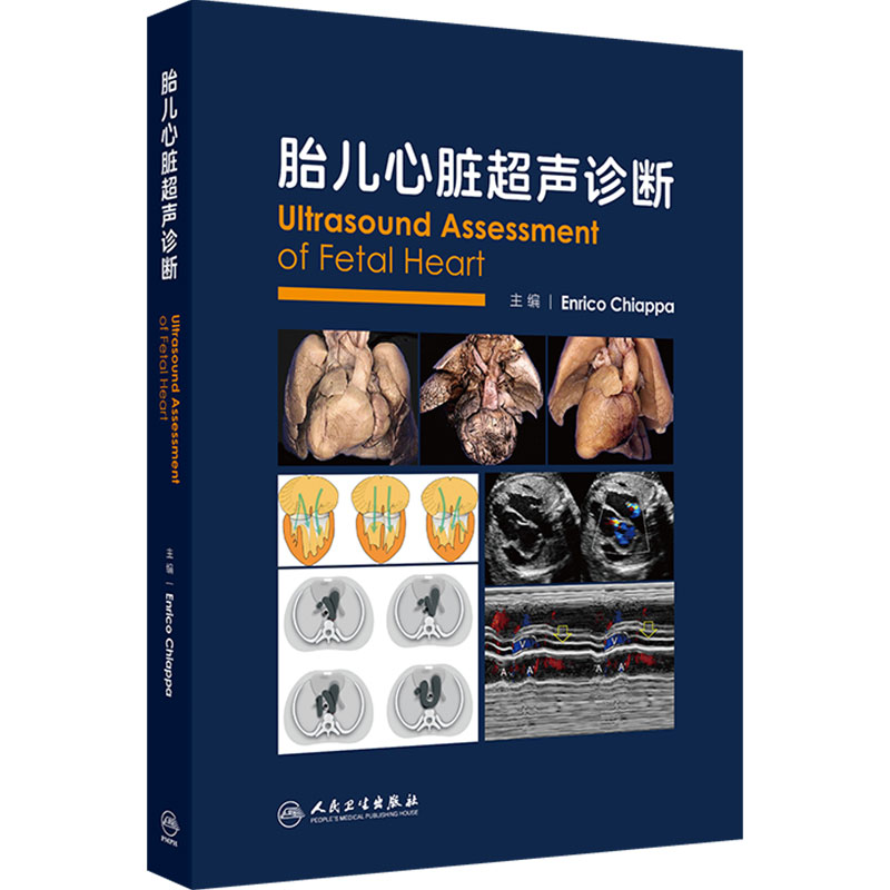 胎儿心脏超声诊断 Enrico Chiappa 主编 适合国内外产科、儿科、心脏外科、超声医学专业从业人员及学生学习阅读 人民卫生出版社