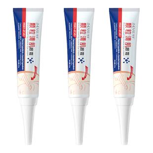 脂肪粒去除神器眼部眼角周油脂粒脂肪专用眼霜去粉刺闭口旗舰店