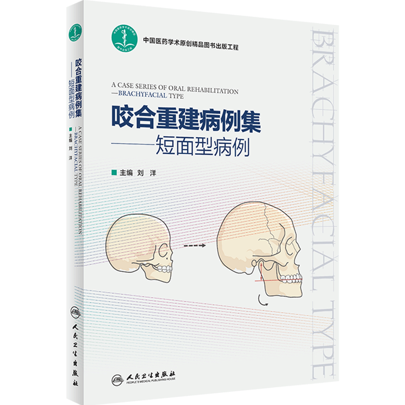 咬合重建病例集——短面型病例