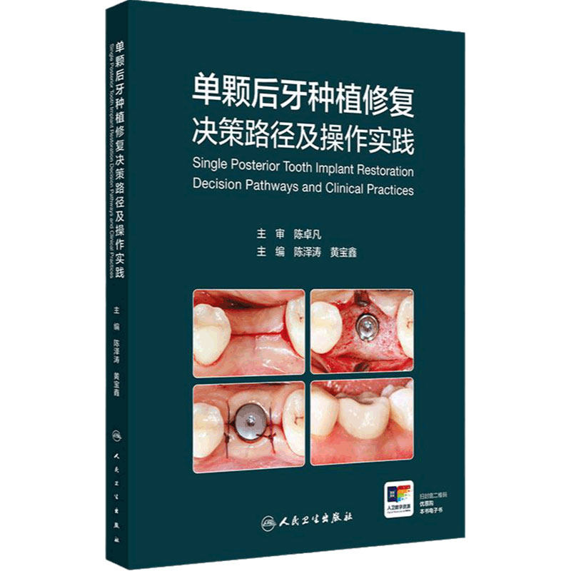 单颗后牙种植修复决策路径及操作实践人卫儿童二期戴种植冠搭并发症满毅精准植入技巧规范化治疗清单根管牙周拔牙牙科护理口腔书籍