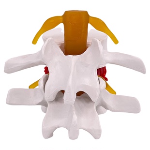 腰椎放大腰椎间盘受压演示模型人体脊柱脊椎骨病理演示关节医学用