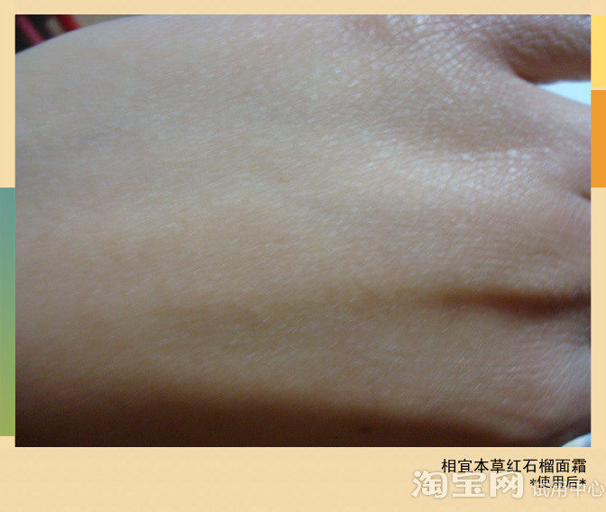 相宜本草红石榴面霜