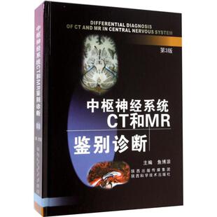 中枢神经系统CT和MR鉴别诊断 第3三版 陕西科技 鱼博浪教授 陕西科技 新华书店正版书 影像书籍