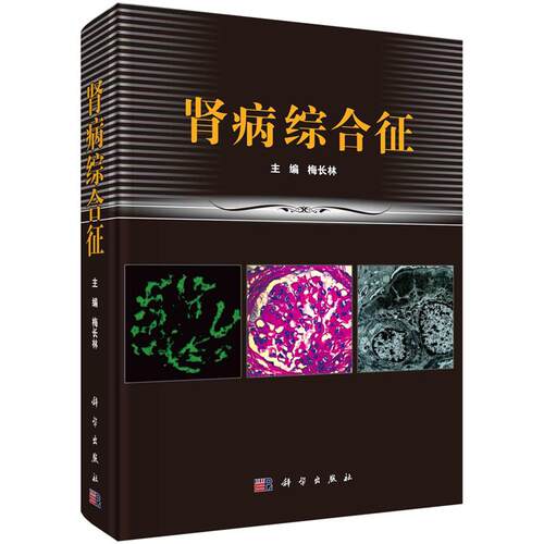 【2025新版】肾病综合征（第2版）梅长林 徐岩 毛志国 主编 9787030817921