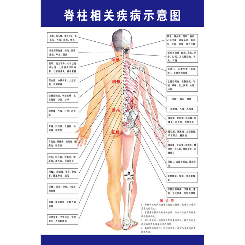 脊柱相关疾病中医养生海报挂图