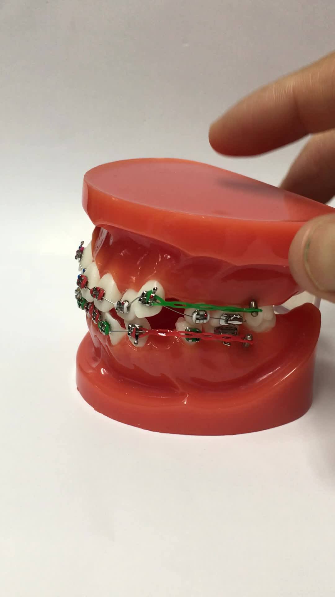 Orthodontic Crimpable Hook And Stops Buy Orthodontic Hook,Orthodontic