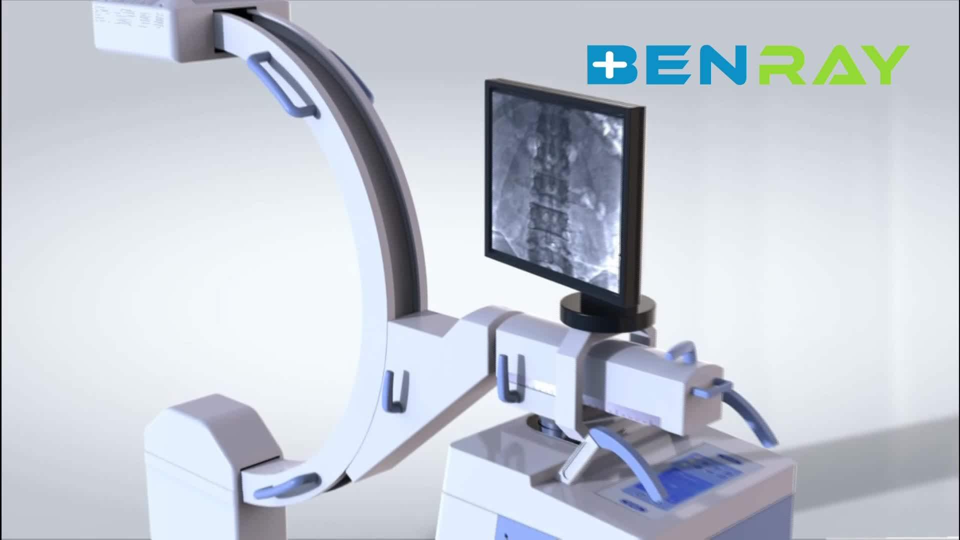 Brca300 Mobile Digital High Frequency Medical Radiology X Ray Machine