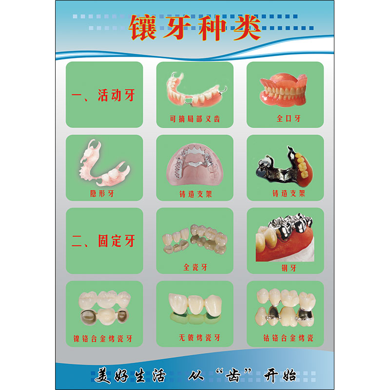口腔牙科诊所广告宣传画牙齿贴面挂图拔牙洗牙装饰挂画镶牙的种类