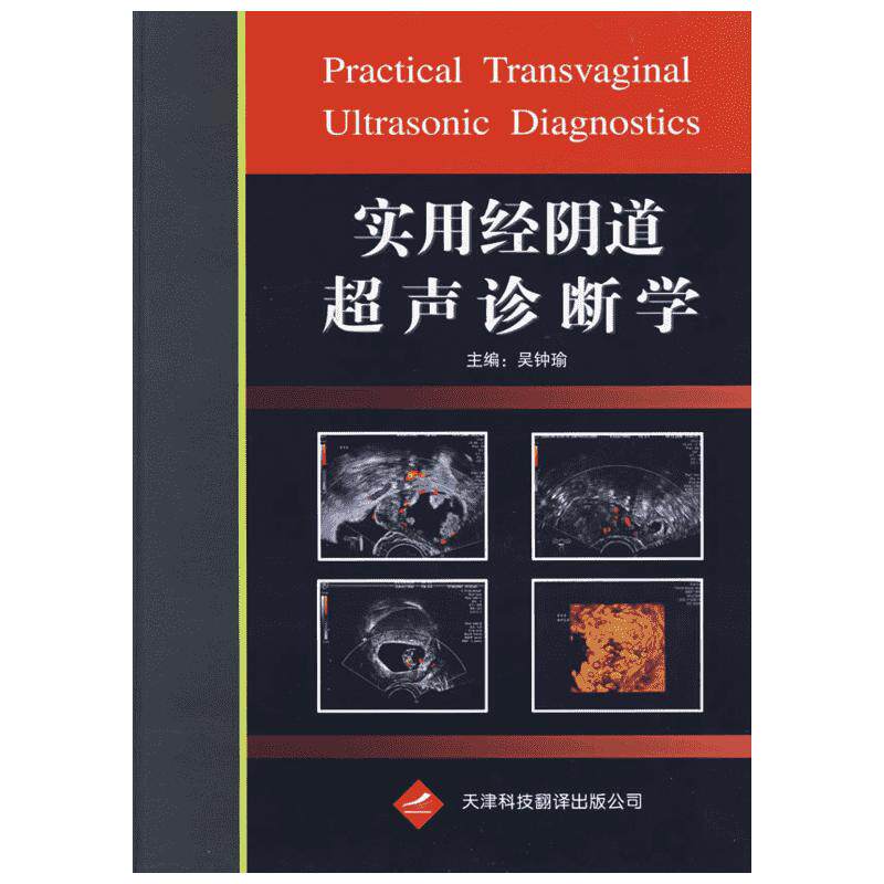 实用经阴道超声诊断学 吴钟瑜　主编 著 影像医学生活 新华书店正版图书籍 天津科技翻译出版有限公司