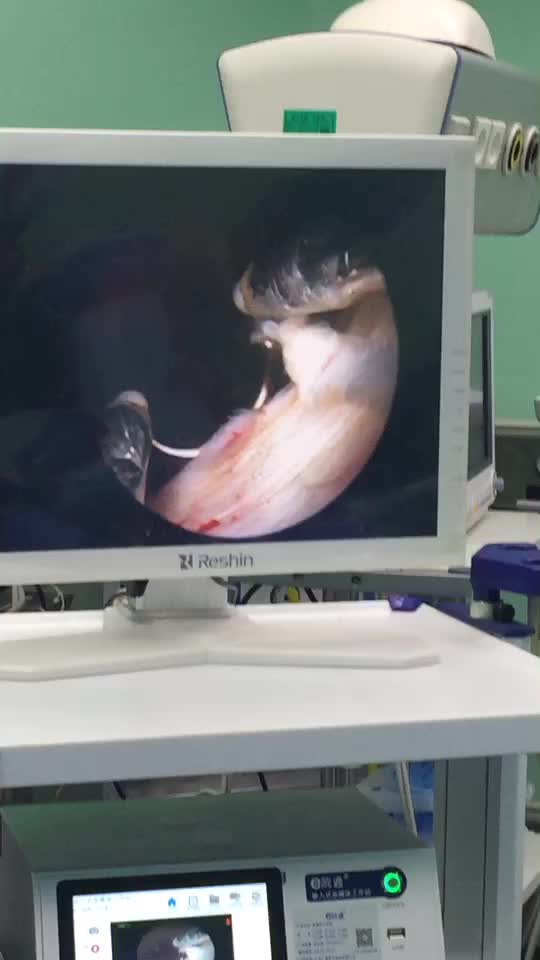 Bonss Urology Turp Cutting Loop Bipolar Loop Electrode For