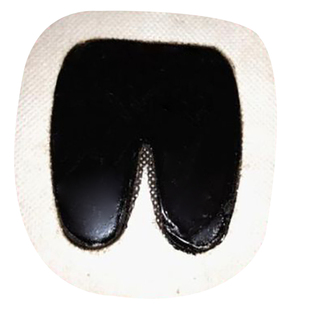 省级非遗王博士牵正膏氏百王小兵面瘫后遗症嘴不正吊斜脸歪牵正贴