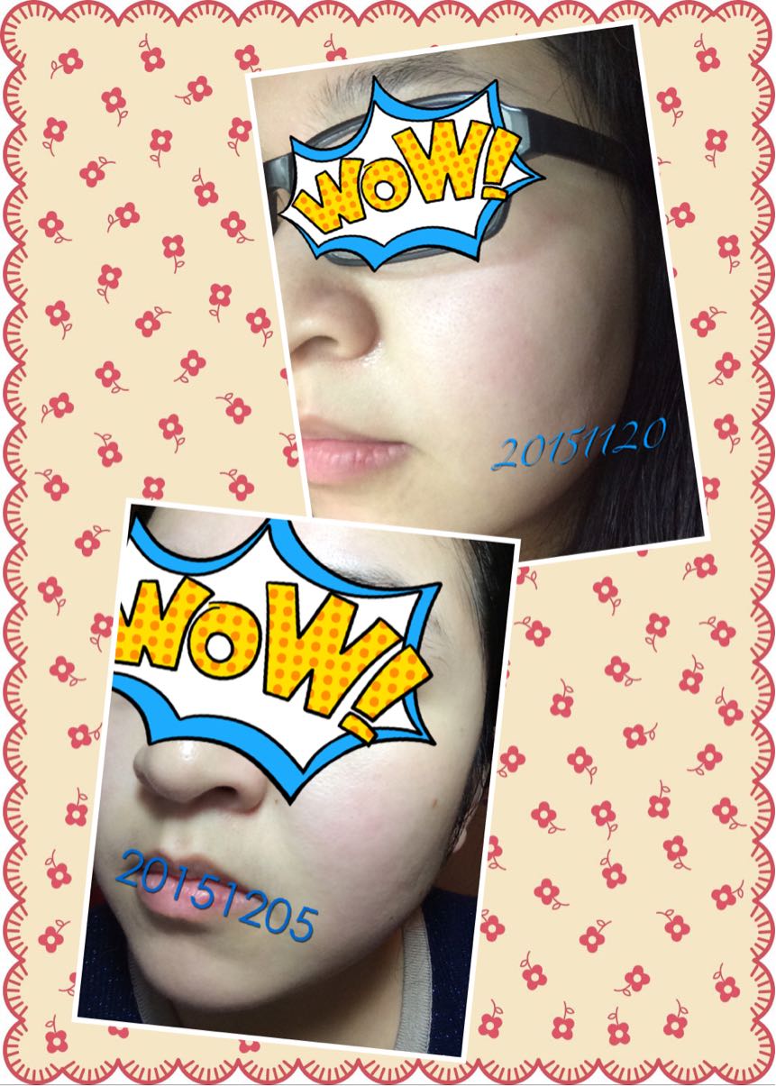 佰草集新七白补水美白套装